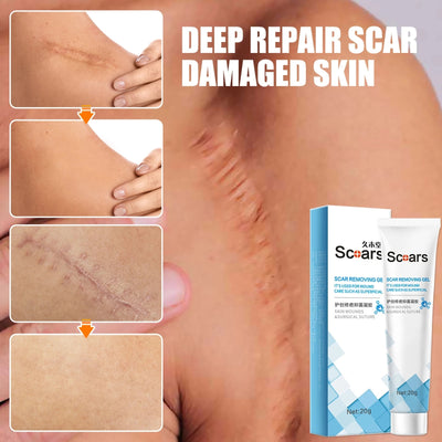 HerbHeal Scar Repair Cream: Restore Your Skin's Natural Beauty