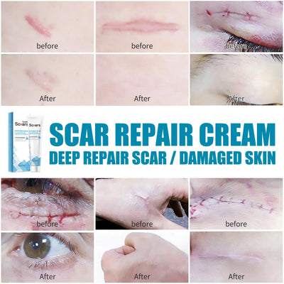 HerbHeal Scar Repair Cream: Restore Your Skin's Natural Beauty