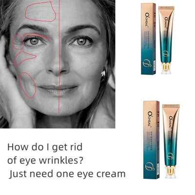 Revitalize and Rejuvenate: Introducing "YouthfulEyes" Anti-Wrinkle Eye Cream